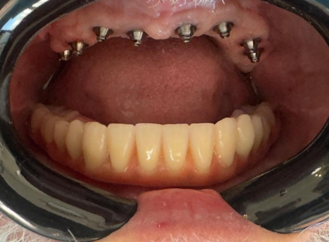 Cópia de Design sem nome (2)